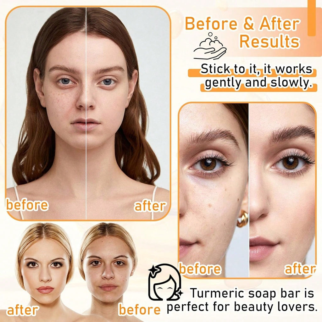 ROFA Turmeric Brightening Soap – Dark Spot & Glow Skin Bar